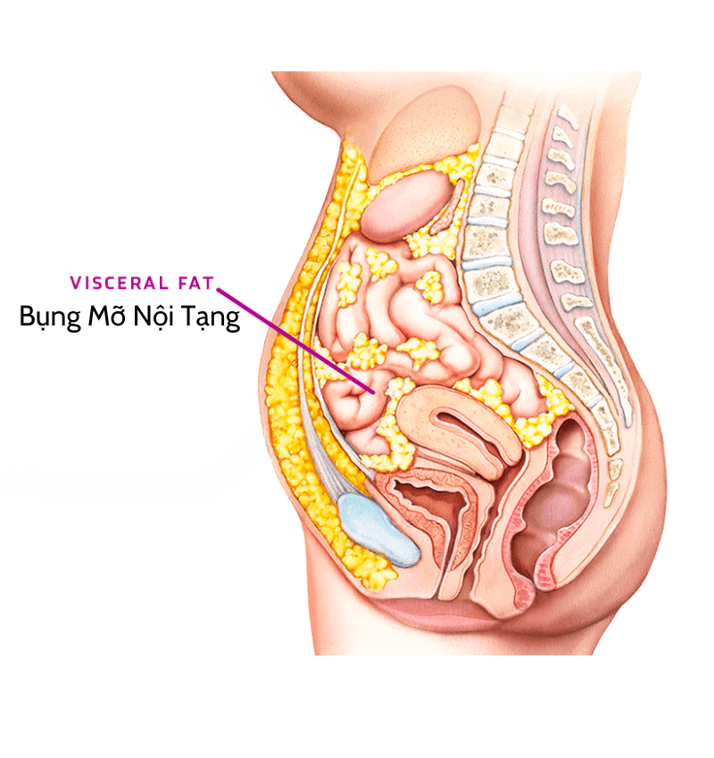 Bụng Mỡ Nội Tạng