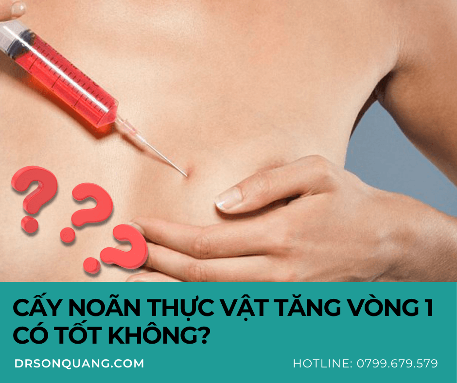 Cấy noãn thực vật tăng vòng 1 có tốt không