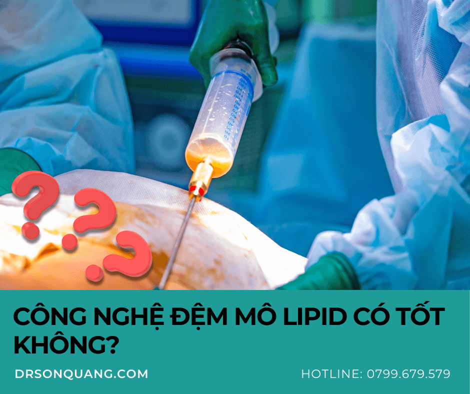 Công Nghệ Đệm Mô Lipid Có Tốt Không?