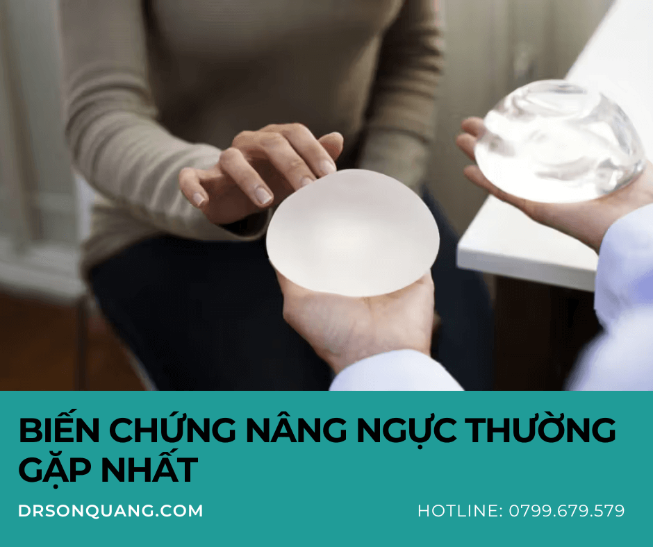 Biến chứng nâng ngực phổ biến nhất