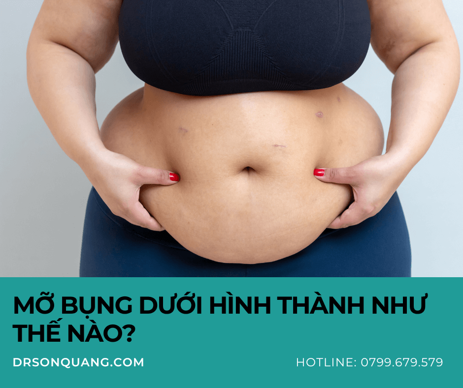 Mỡ bụng dưới hình thành như thế nào?