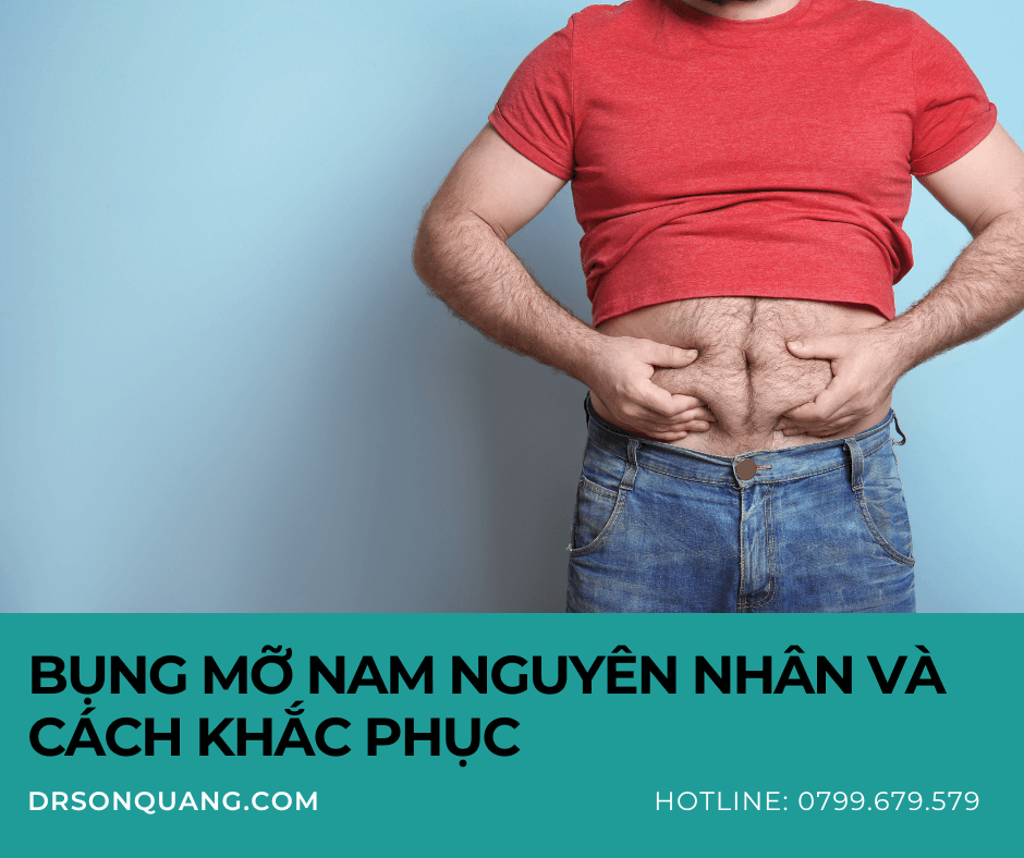 Bụng mỡ nam Nguyên nhân và cách khắc phục