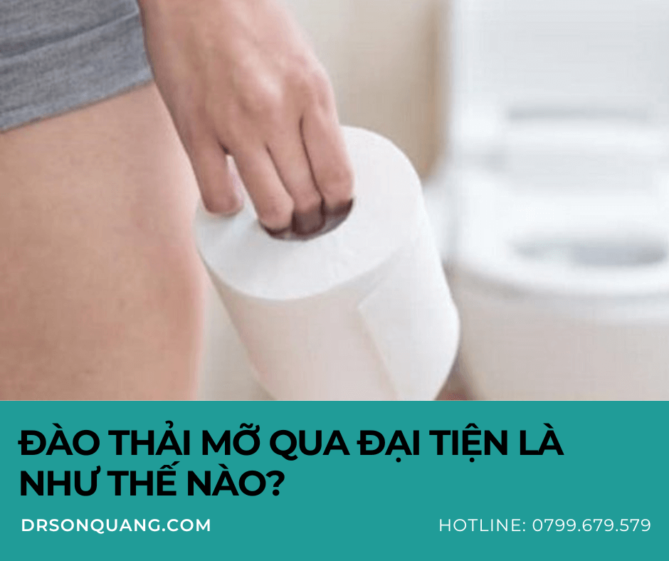 Đào thải mỡ qua đại tiện