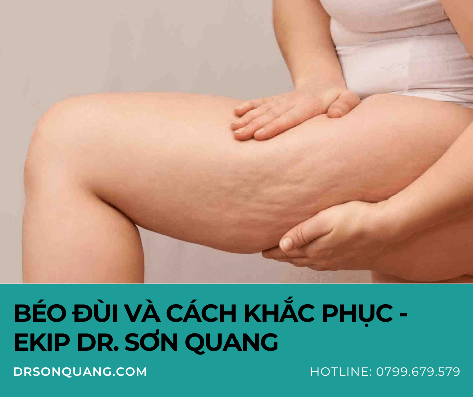 Đùi to và cách khắc phục