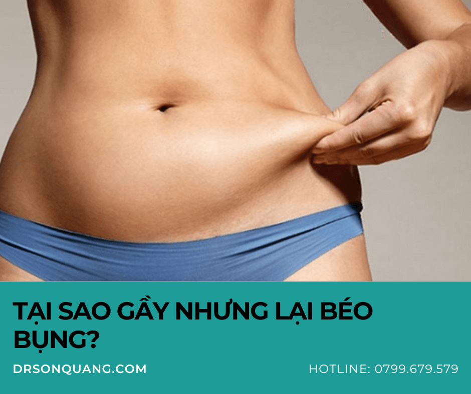 Tại sao gầy nhưng lại béo bụng