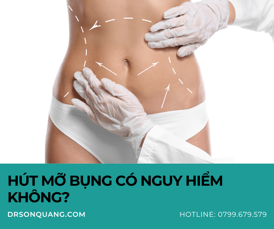 Hút Mỡ Bụng Có Nguy Hiểm Không?