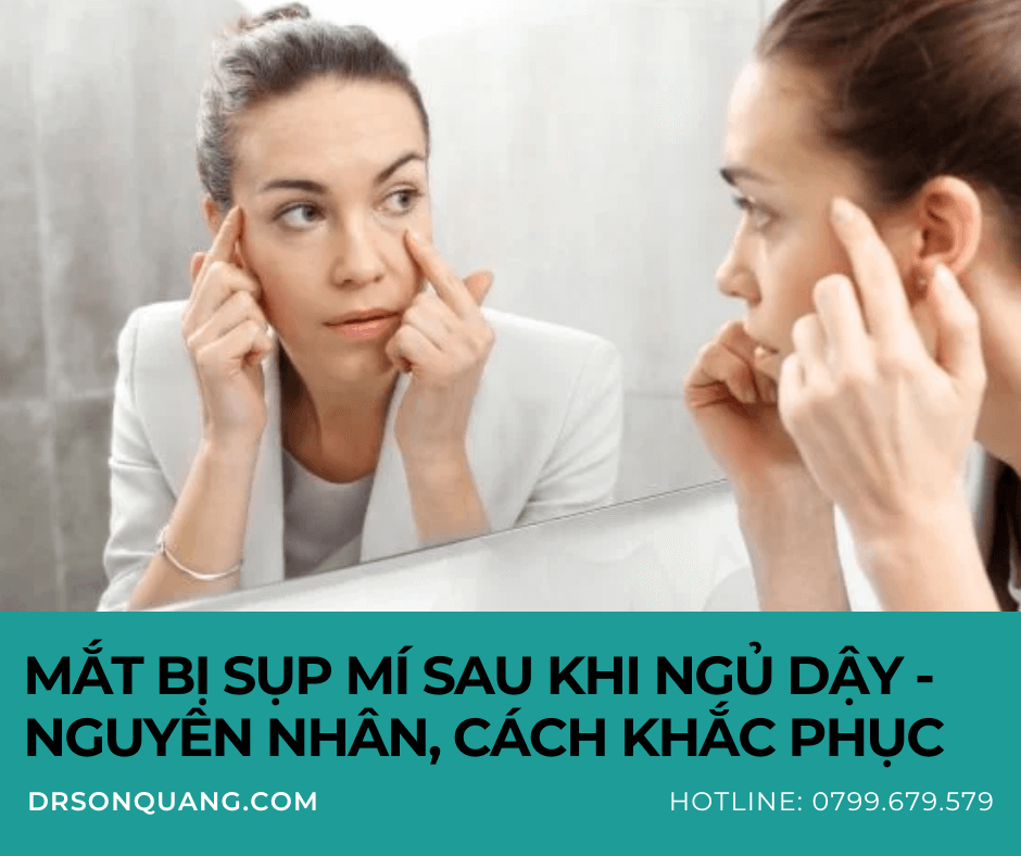 Mắt bị sụp mí sau khi ngủ dậy