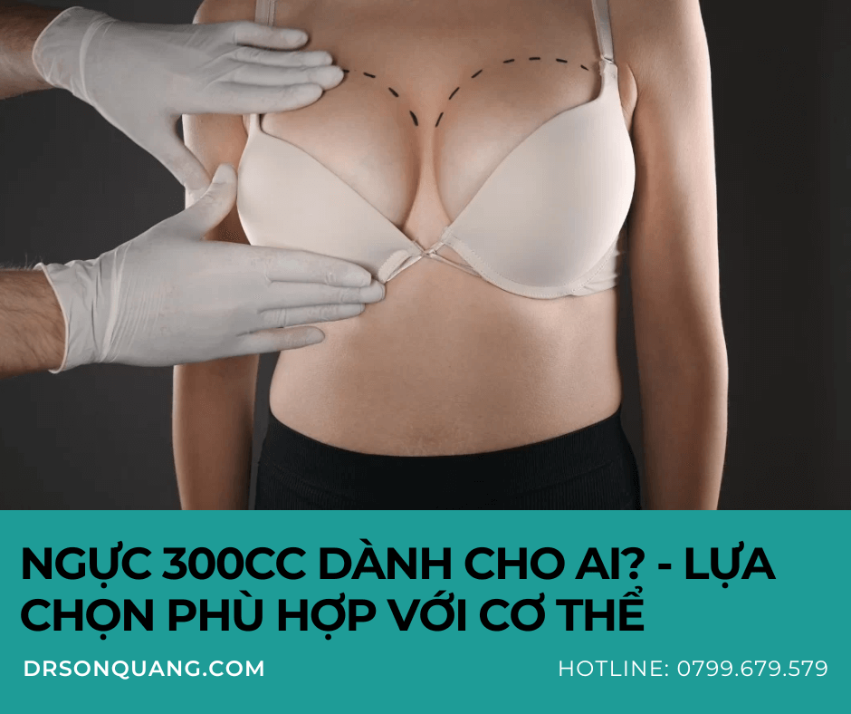 Ngực 300cc dành cho ai? - Lựa chọn phù hợp với cơ thể