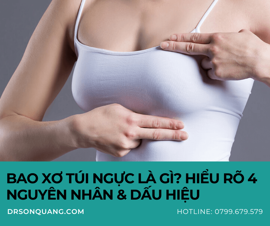 Bao xơ túi ngực là gì? Hiểu rõ 4 nguyên nhân & dấu hiệu