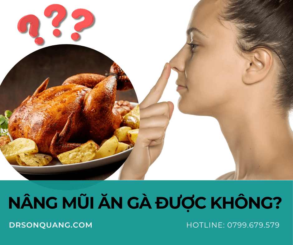 Nâng Mũi Ăn Gà Được Không?