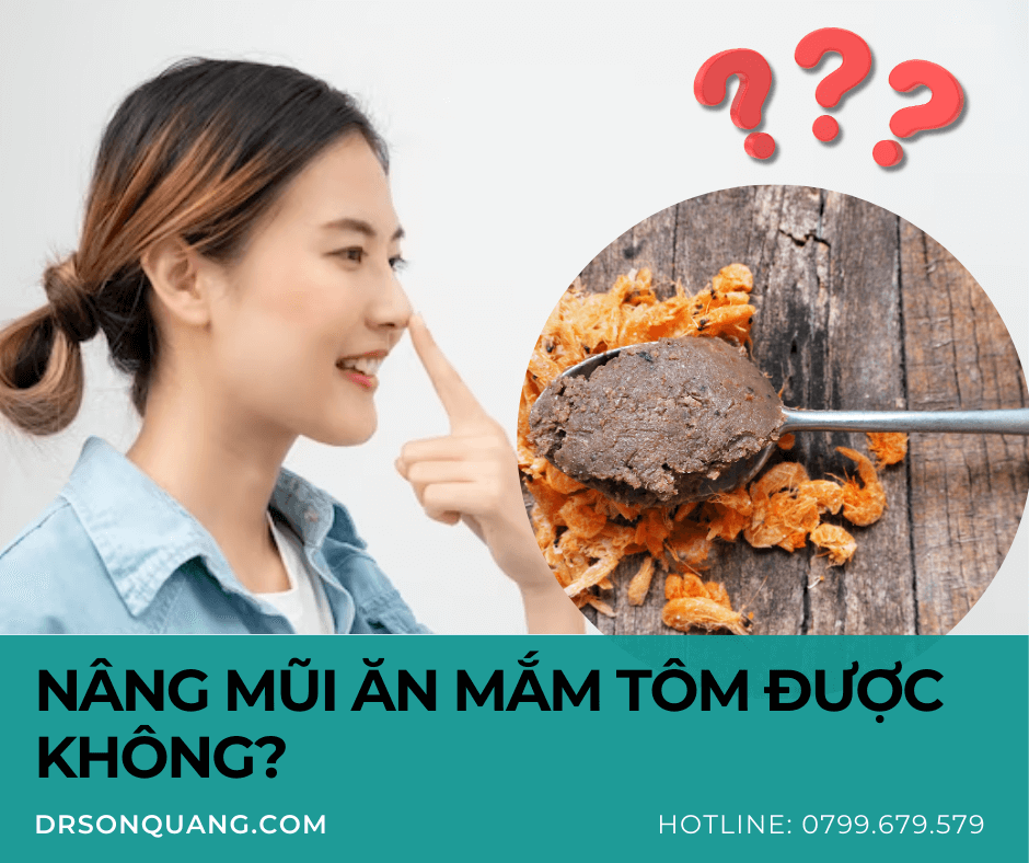 Nâng mũi ăn mắm tôm được không?