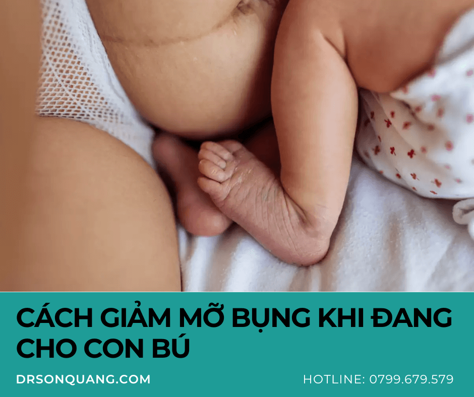 Cách Giảm Mỡ Bụng Khi Đang Cho Con Bú: Bí Quyết An Toàn và Hiệu Quả