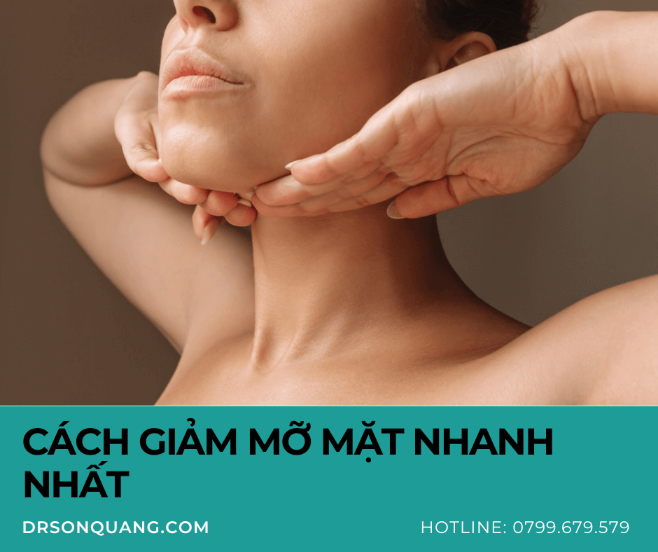 Cách Giảm Mỡ Mặt Nhanh Nhất: Bí Quyết Từ Chuyên Gia